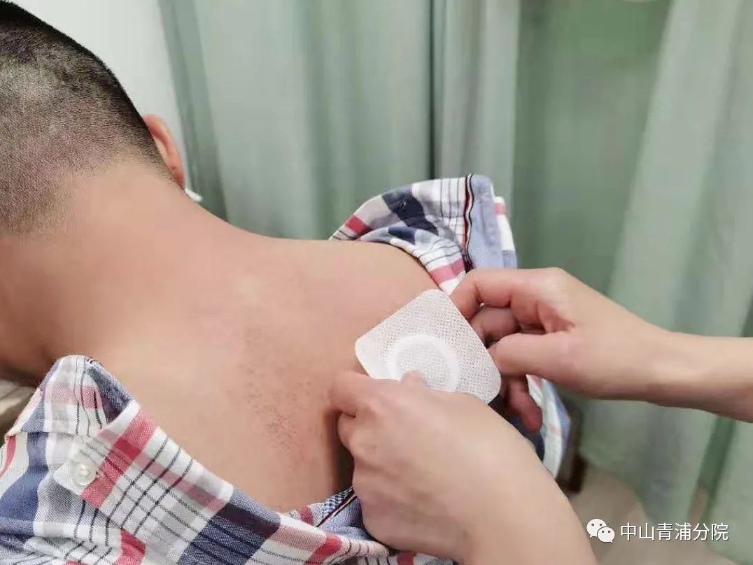 2、江西兒童貼三伏貼癢灼痛，什么體質的人可以貼三伏貼癢灼痛？